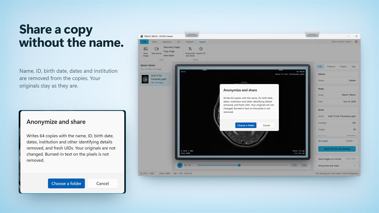 Share an anonymized copy without the patient's name.