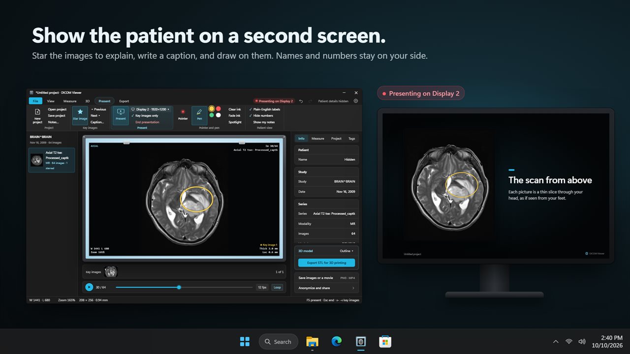 Walk a patient through their scan on a second screen.