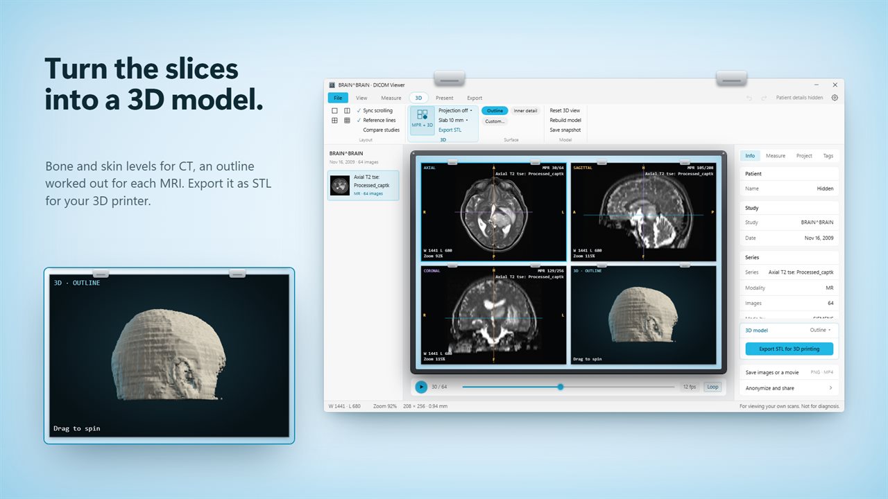 Turn the slices into a 3D model and export it as STL.